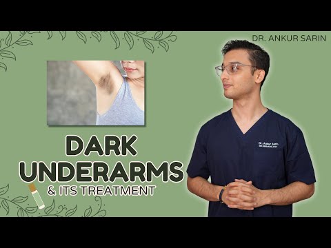 Dark Underarm Treatment
