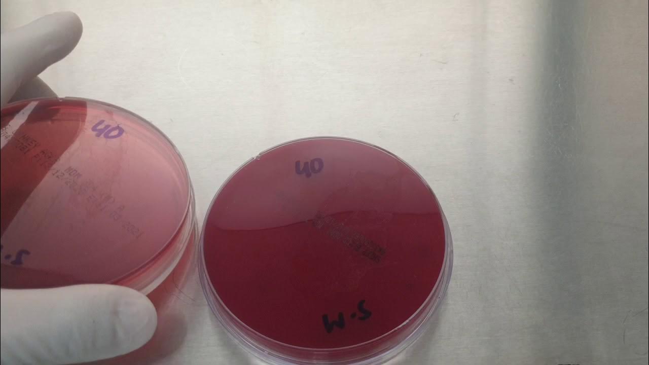 Wound swab culture YouTube