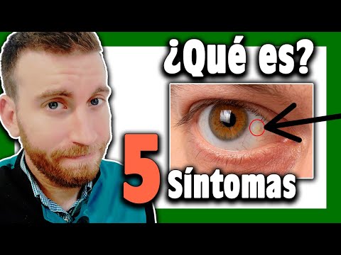🟩 ¿Qué es