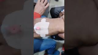 Cannulation Long Video Part 22 