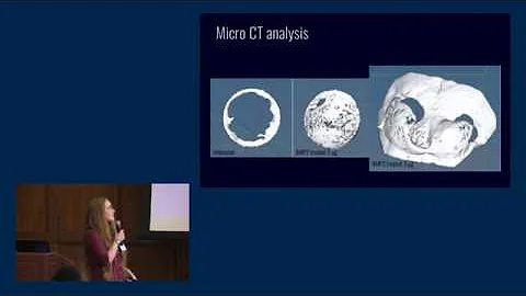 UROP Summer Symposium - Kathleen Conner Oral Prese...