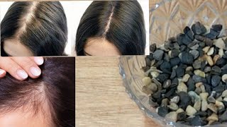 علاج تساقط الشعر نهائيا اسرع طريقة لمنع تساقط وتطويل الشعر???