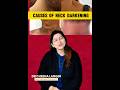 CAUSES OF NECK DARKENING | NECK DARKENING K REASONS | DR CHEENA LANGER | #neckdarkening