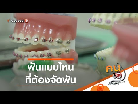 ฟันแบบไหน ที่ต้องจัดฟัน : รู้สู้โรค (20 ม.ค. 64)