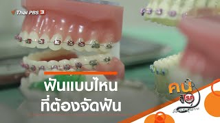 ฟันแบบไหน ที่ต้องจัดฟัน : รู้สู้โรค (20 ม.ค. 64)