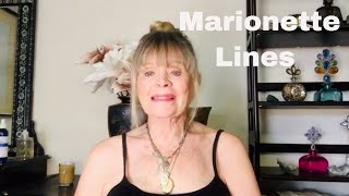 How To  Improve Marionette Lines Without Injectables. @joellamilanskincare5122