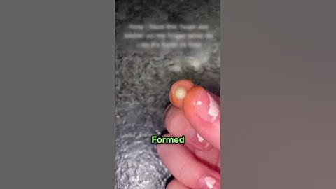 Truth About Blister 😳