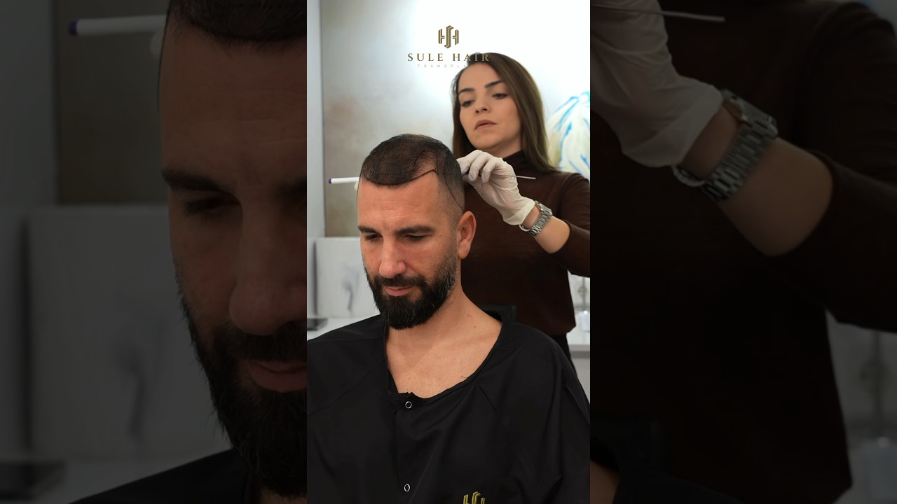 The Hairline Planning pre-operation with our experts ! Get a consultation now.