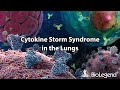 Cytokine Storm Syndrome in the Lungs