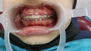 orthodontic case report