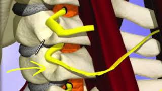 Subluxation and neck pain