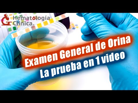 ¿Te Ven Orinar Para La Prueba De Drogas De Empleo?