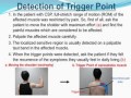 RCT Of Trigger Point Acupuncture For Chronic Shoulder Pain RCT Of Trigger Point Acupuncture For Chronic Shoulder Pain