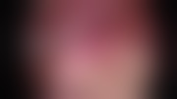 Appendicular perforation