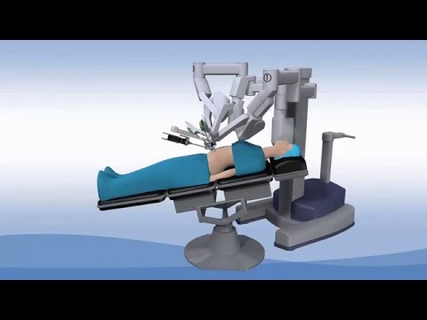 فيديو: متى تم اختراع الجراحة طفيفة التوغل؟