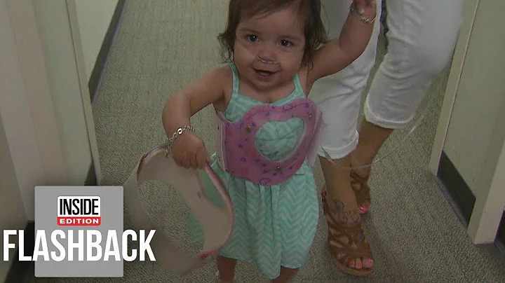 Meet the Miracle Baby Born With Her Heart Outside ...