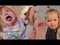 Doctor Adley removes Stitches!!  Brave Mom & Kids surprise me with drone! family pirate island visit