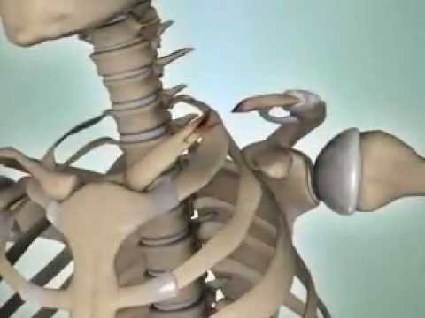 Shoulder Fractures - DePuy Videos