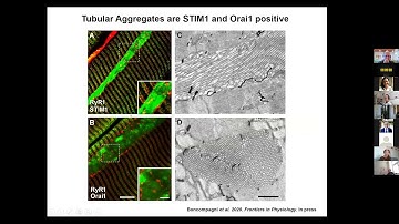 Simona Boncompagni - "Formation in tubular aggregates in muscle: role of STIM1 and Orai1"