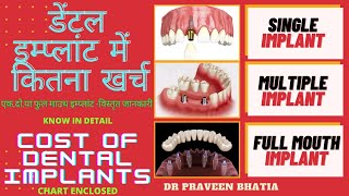 डेंटल इम्प्लांट मैं कितना खर्च -एक,दो,या फुल माउथ -विस्तृत जानकारी COST of Dental implants in detail