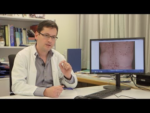 Video: Atopische Dermatitis. Psychosomatik Der Neurodermitis