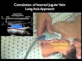 How To: Ultrasound Guidance for Central Venous Access Part 2 Case Study Video