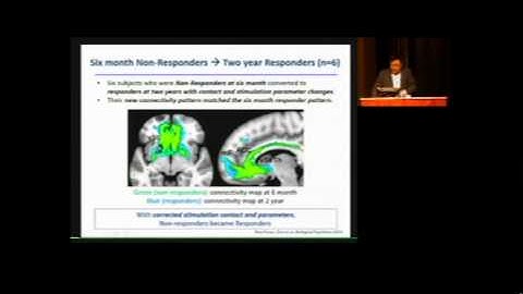 BrainSTIM2015, Ki Sueng Choi, AM#2, Surgical Target Selection for Subcallosal Cingulate DBS...