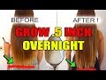 GROW  5 INCH OVERNIGHT!! From first use Get Long Hair BACK OVERNIGHT  HAIR GROWTH HACKS HAIR CARE TI