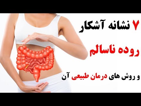 تصویری: آیا سنبله های وزوز از بین می روند؟