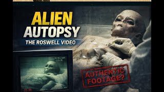 Alien Autopsy Footage Examined — The Roswell Video That Still Defies Explanation