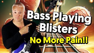 Bass Playing Tips For Avoiding Blisters and Sore Fingers - It&#39;s All In The Amp Settings!