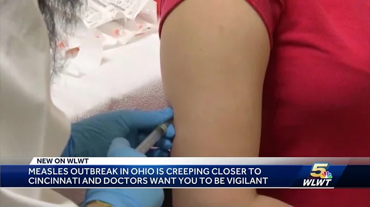 With Ohio measles outbreak spreading, Cincinnati doctors urge families to get vaccinated