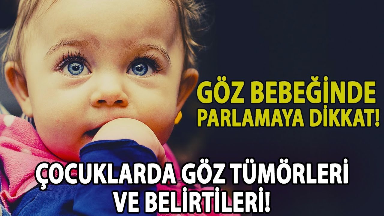 Çocuklarda Göz Tümörleri ve Belirtileri! Göz Bebeğinde Parlamaya Dikkat!