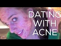 💕 Dating With Acne. My Story, Relationships & Opinions | Cassandra Bankson