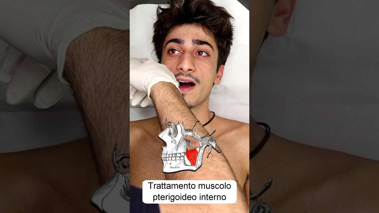 Dolore temporo mandibolare: Trattamento osteopatico #shorts