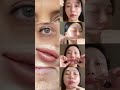 페이스 요가 4가지 동작 #팔자주름#얼굴리프팅#faceyoga