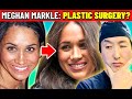 Did MEGHAN MARKLE Have PLASTIC SURGERY? One Plastic Surgeon's Opinion - Dr. Anthony Youn