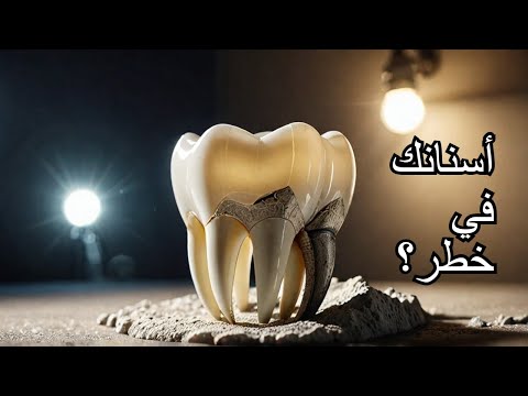 هل نقص فيتامين د يؤثر على الأسنان