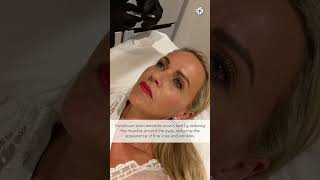 Injectables For Crows Feet