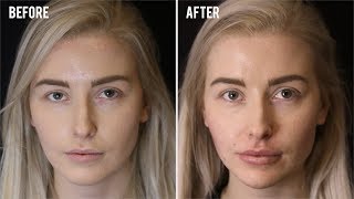 How To Fix An Asymmetrical Face with Dr Adam | SkinViva