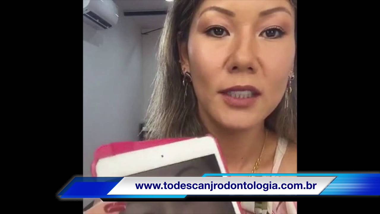 Paciente veio do Japão para tratar os dentes