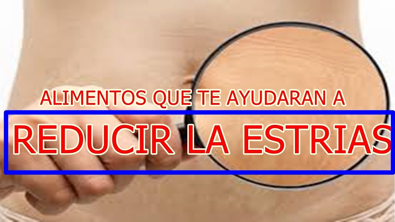 ALIMENTOS QUE TE AYUDARAN A ELIMINAR LAS ESTRIAS camera iphone 8 plus apk
