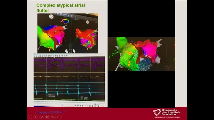 Dr. Sengupta, Dr. Sorajja and Dr. Brilakis - 2019 ...