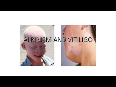 Video: Verschil Tussen Albinisme En Vitiligo