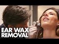 MEDICAL EAR WAX EXTRACTION (Beauty Trippin)