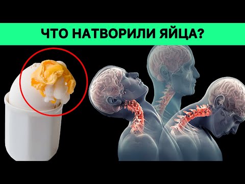 Ела по 2 вареных яйца в день и вот что произошло с моим телом...Что натворили яйца?