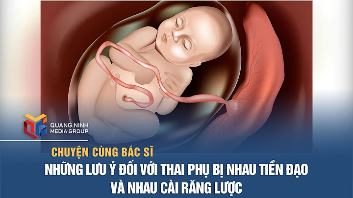 Rau cài răng lược là gì năm 2024