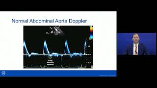 Coarctation of the Aorta-Imaging and Management