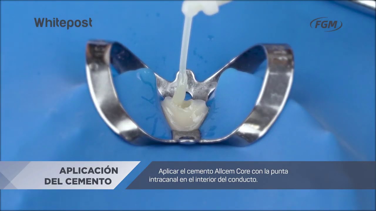 Paso a Paso de los postes de fibra de vidrio Whitepost FGM