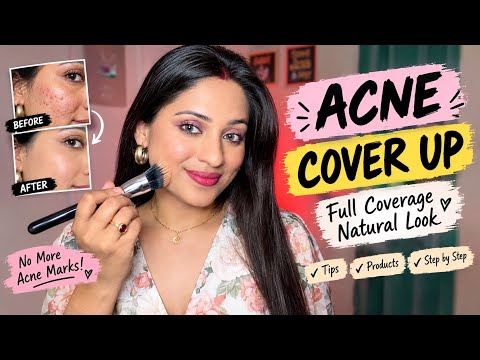ACNE & ACNE MARKS COVER UP | Full Coverage Makeup for Acne Prone Skin | Step by Step Tutorial